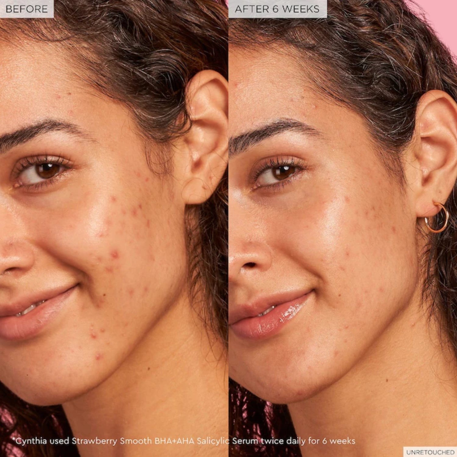 STRAWBERRY SMOOTH BHA+AHA SALICYLIC SERUM (SUERO PARA EL ROSTRO)
